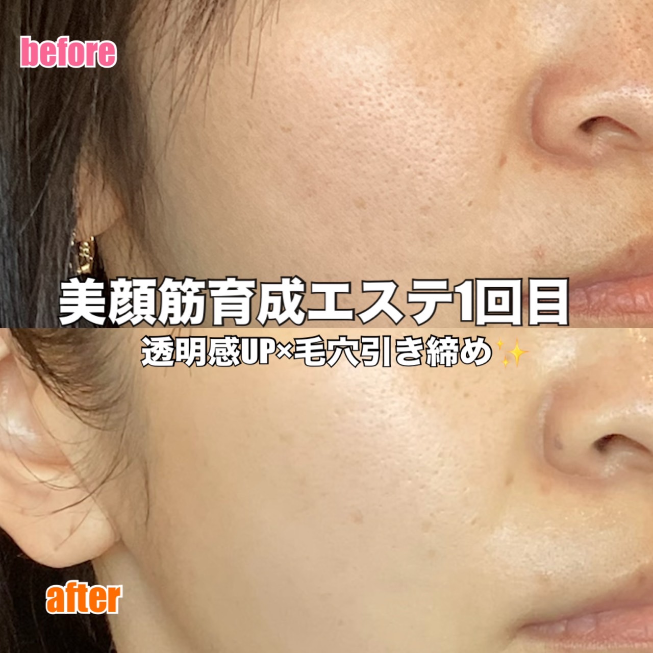 肌の悩みを早く改善したい
